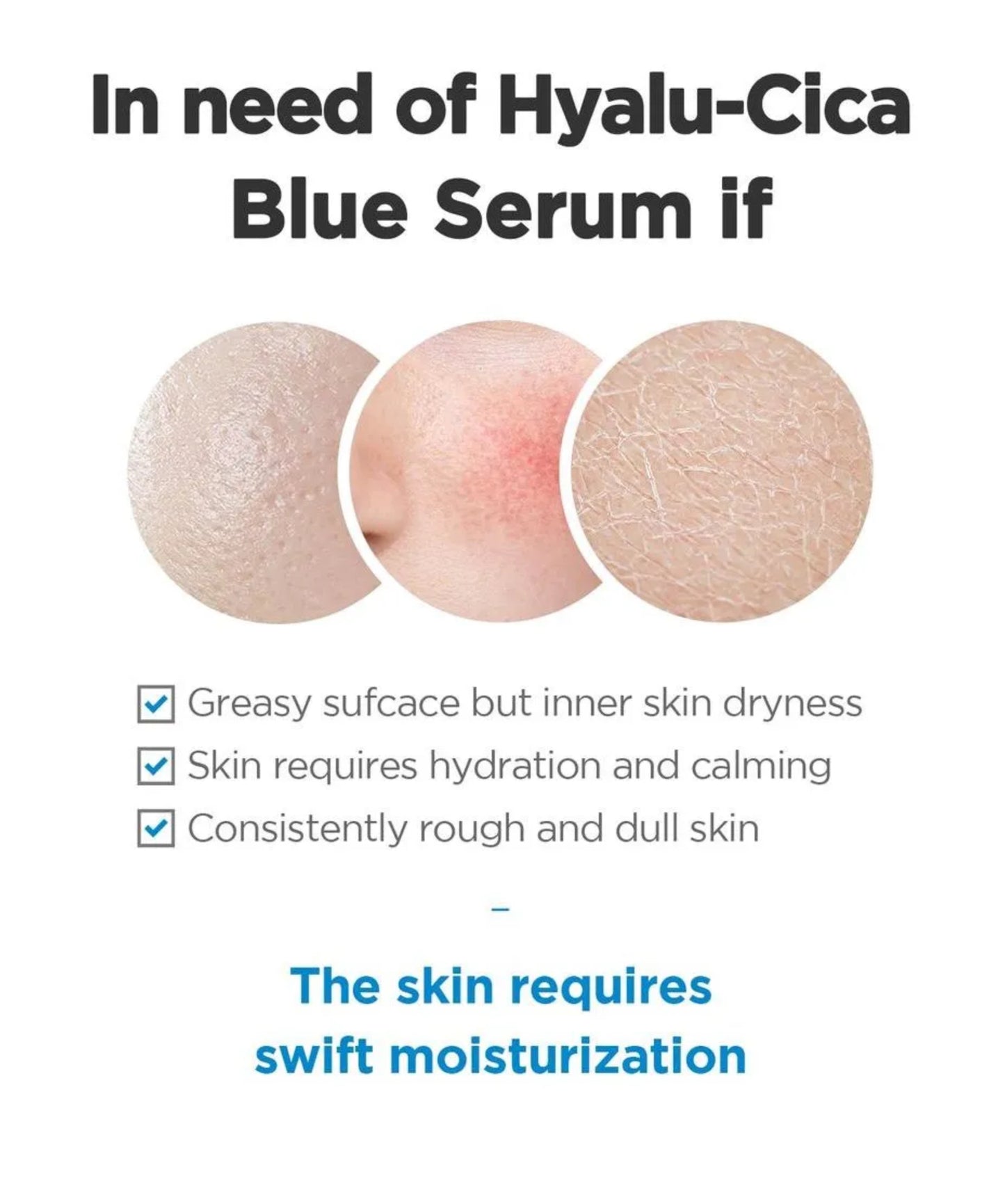 SKIN 1004 - Madagascar Centella Hyalu-Cica Blue Serum 50ml