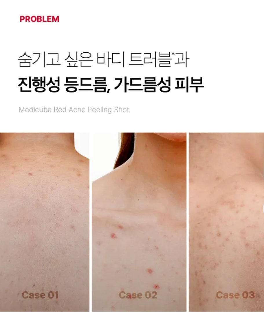 medicube - Red Acne Body Peeling Shot 110g